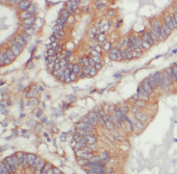 PCBP1 Antibody