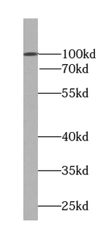 RNF31 Antibody