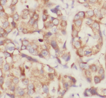 RNF31 Antibody