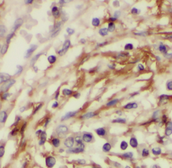 PSMC3IP Antibody