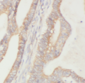 HDGFL2 Antibody
