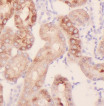WNK1 Antibody