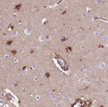 HuA/B/C/D Antibody