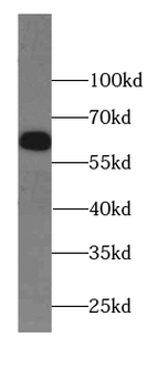 IFIT1B Antibody