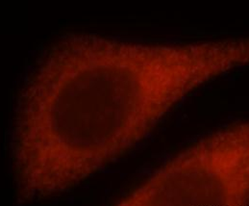 IFITM3 Antibody