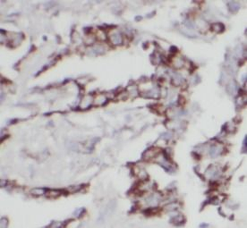 IFITM3 Antibody