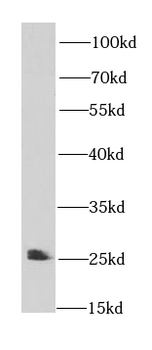 IFT25 Antibody