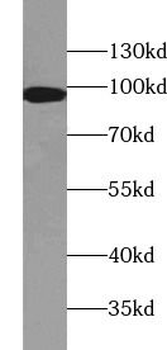 IFT88 Mouse Monoclonal Antibody