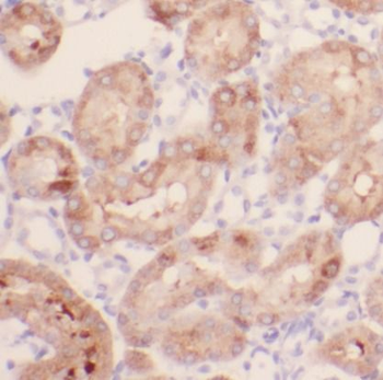 IFT88 Mouse Monoclonal Antibody