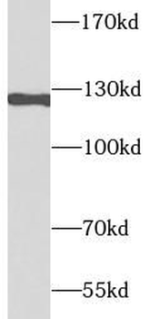 IGF1R Rabbit Polyclonal Antibody