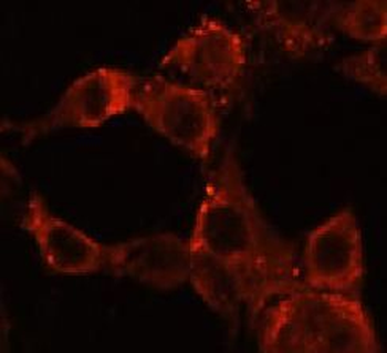 IGF1R Rabbit Polyclonal Antibody