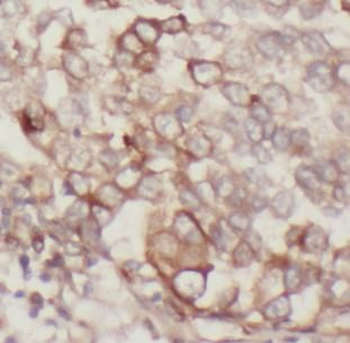 IGF1R Rabbit Polyclonal Antibody