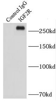 IGF2R Antibody