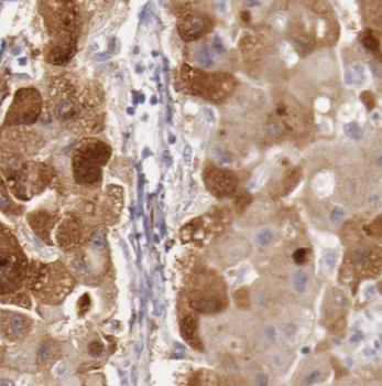 IGF2R Antibody