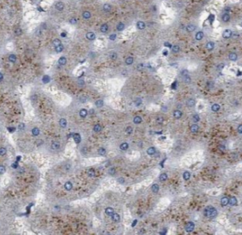 MIIP Antibody