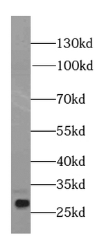 IL17D Mouse Monoclonal Antibody
