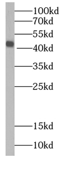 IL36RN Antibody