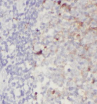 IL36B Antibody