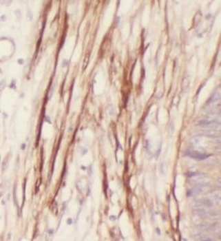 IL36G Antibody