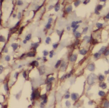 KPNB1 Antibody