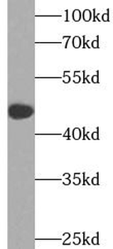 INHBA Mouse Monoclonal Antibody