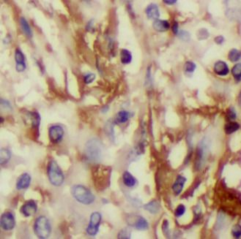 INHBA Mouse Monoclonal Antibody