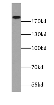 ITGA1 Rabbit Polyclonal Antibody