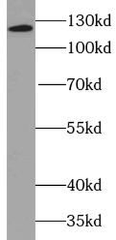 ITGA3 Mouse Monoclonal Antibody