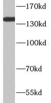ITGA4 Rabbit Polyclonal Antibody
