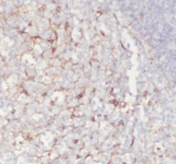 ITGA4 Rabbit Polyclonal Antibody