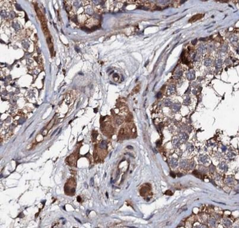 ITGB3 Antibody