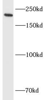 ITGB4 Rabbit Polyclonal Antibody