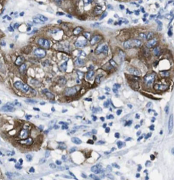 ITGB4 Rabbit Polyclonal Antibody