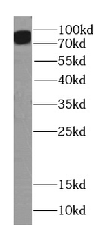 ITGB6 Antibody