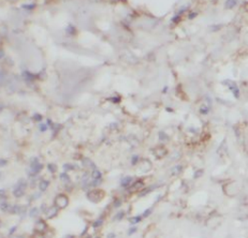 ITGB6 Antibody