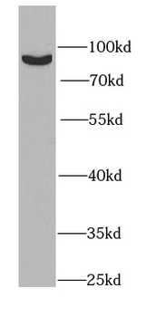 PLA2G6 Rabbit Polyclonal Antibody