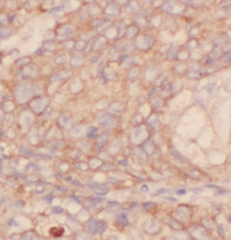 IVD Antibody