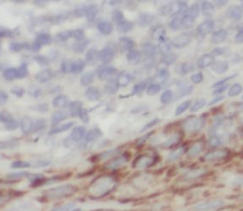 KLK5 Antibody