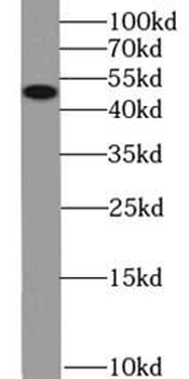 KCNN4 Mouse Monoclonal Antibody