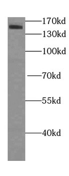 KDM3A Antibody