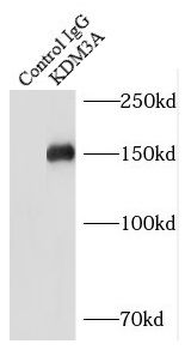 KDM3A Antibody