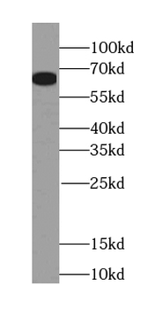 KGA/GAC Rabbit Polyclonal Antibody