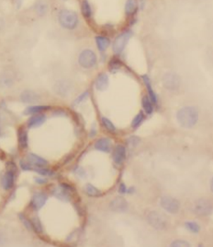 KGA Specific Rabbit Polyclonal Antibody