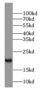 FAM30A Rabbit Polyclonal Antibody