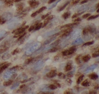 FAM30A Rabbit Polyclonal Antibody