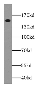 MTUS2 Antibody
