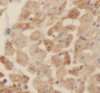 MTUS2 Antibody