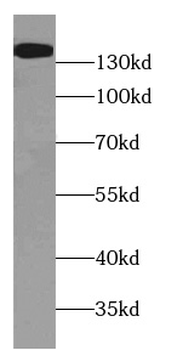 WASHC4 Rabbit Polyclonal Antibody