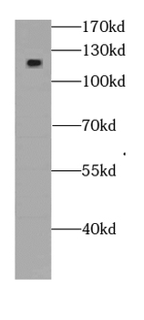 KIAA1217 Rabbit Polyclonal Antibody