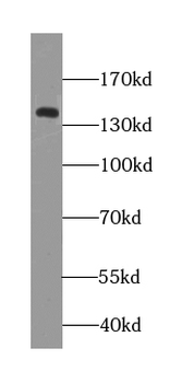 NCKAP5L Rabbit Polyclonal Antibody